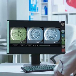 View of ARMS Embryo Watch: Real-Time Embryo Development Monitoring